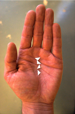 {Les vestiges de demain,} 2011 