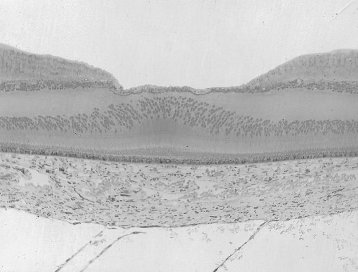 Paysage de la rétine (coupe histologique d'une rétine humaine)
