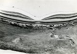 Paysage de la rétine (coupe histologique d'une rétine humaine)