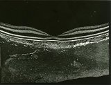 Paysage de la rétine (coupe histologique d'une rétine humaine)
